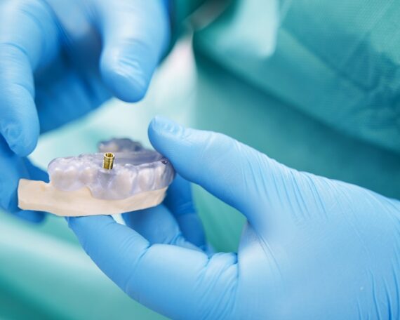 Postępowanie pooperacyjne - jak dbać o miejsce implantacji?